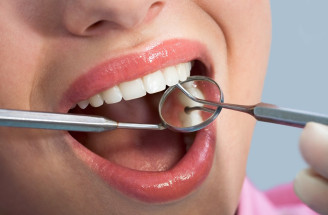 Zubný kaz – čo všetko o ňom potrebujeme vedieť?
