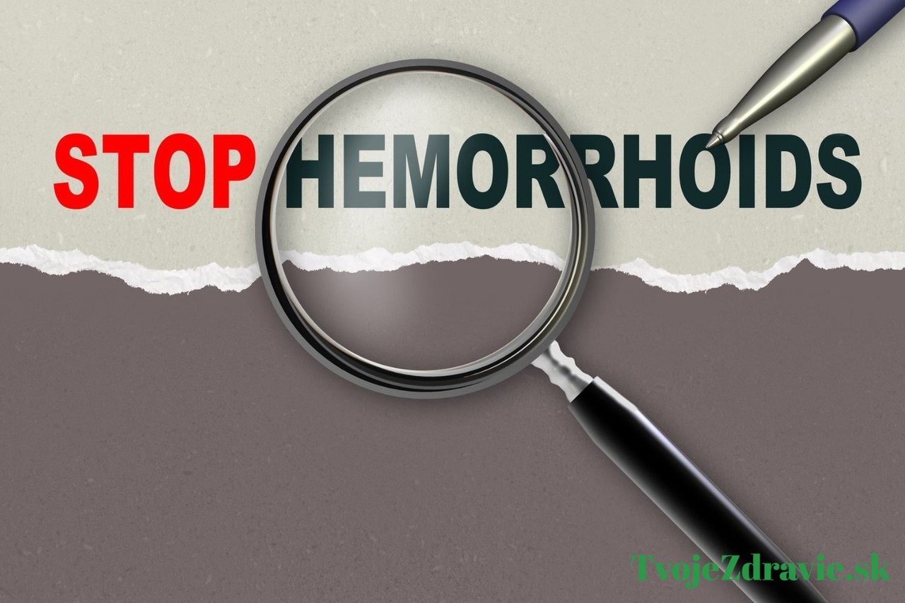 vonkajšie hemoroidy liečba