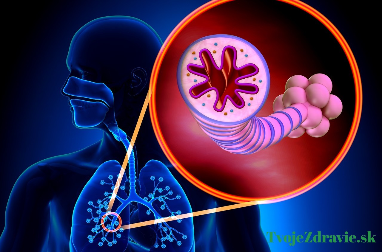 príznaky astmy