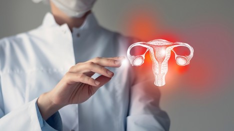 Endometrióza – aké príznaky na ňu môžu u žien poukazovať?