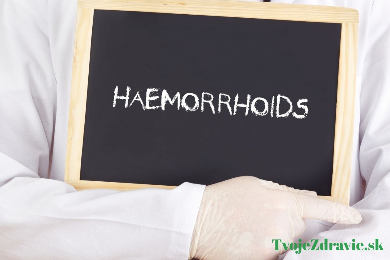 hemoroidy liečba
