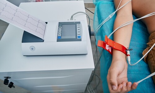 EKG kardiografy a zapisovače pre monitorovanie činnosti srdca