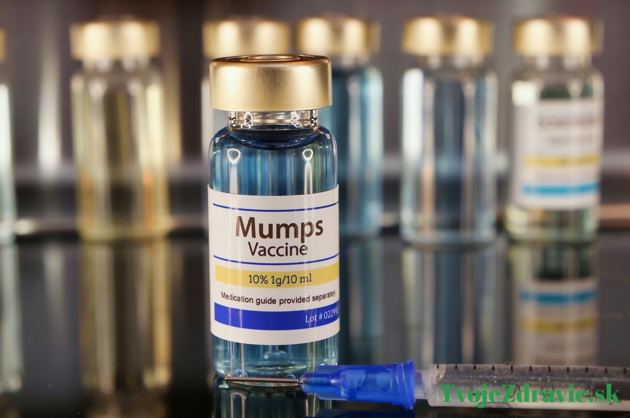 mumps očkovanie